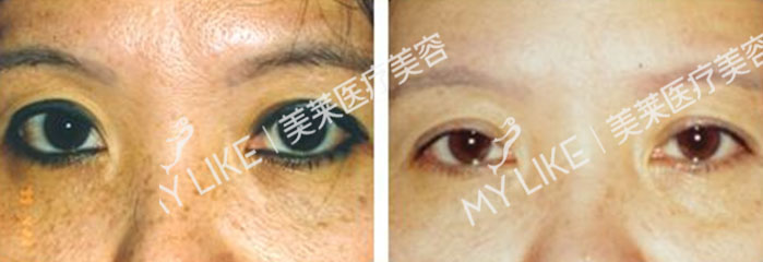 洗纹绣1.jpg