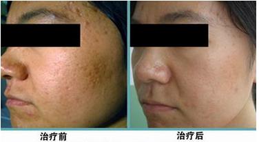 ad531fcb9290104c6be4632424f49831.jpg