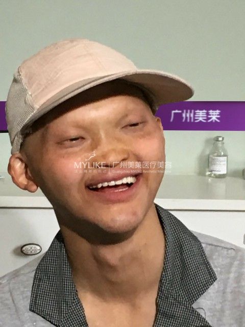 邹先生术后