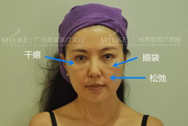 6.webp.jpg