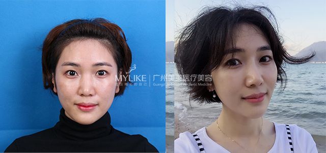 对比照.jpg