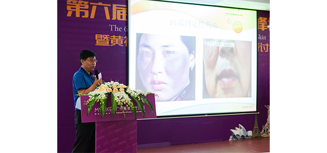 夏文华医生解析如何全面的治疗黄褐斑.jpg