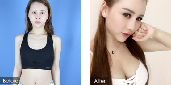 QQ图片20171023175817.png