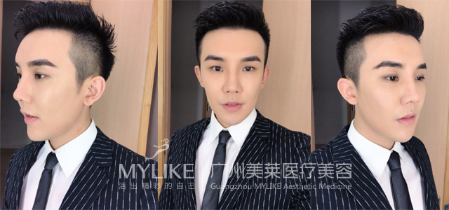 术后.jpg